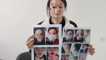 鄭州一女子被企業(yè)家丈夫家暴最新進(jìn)展：已要回孩子撫養(yǎng)權(quán)