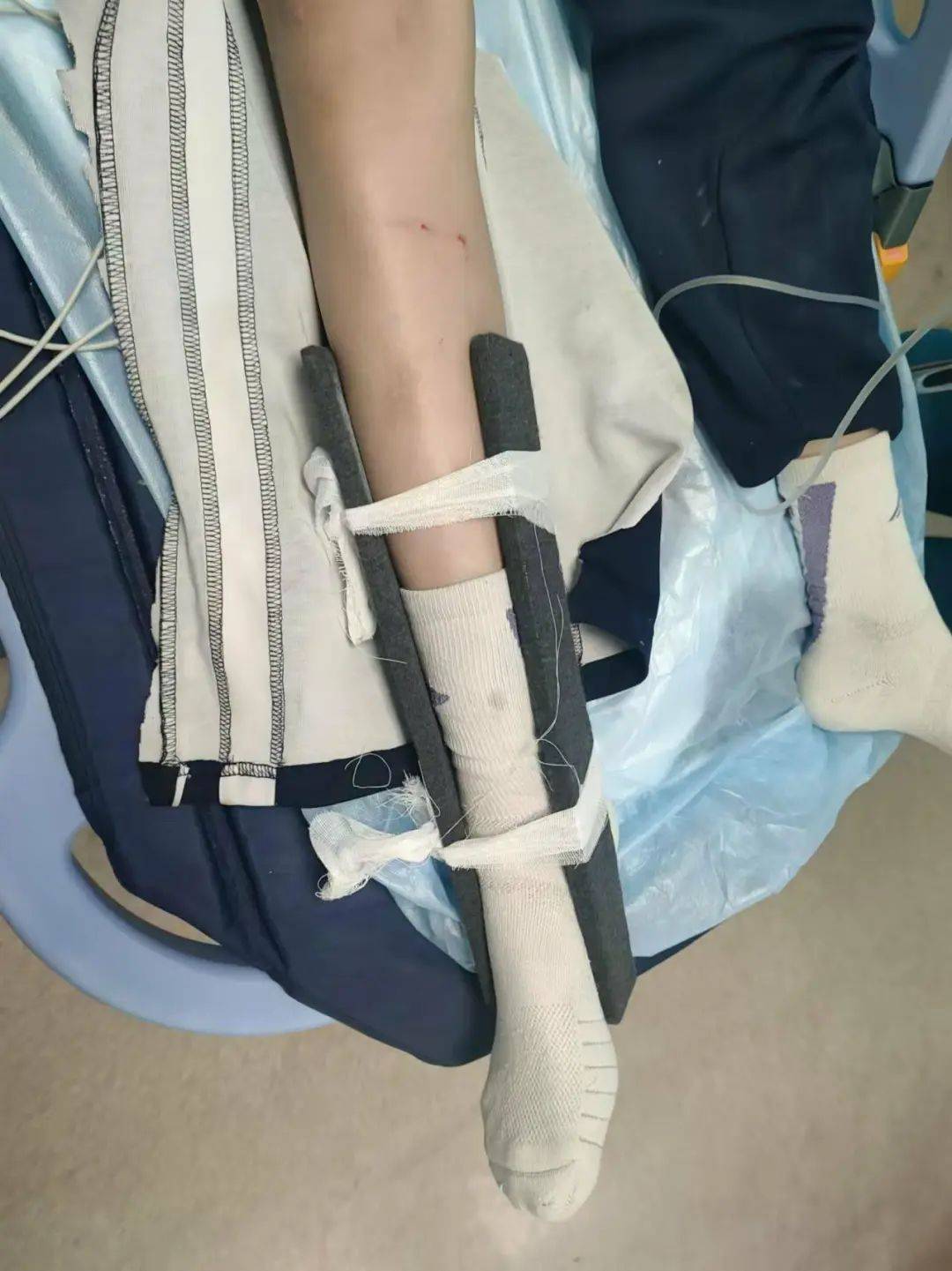 慘痛！一人身亡！深圳多名學生騎電動車發(fā)生意外