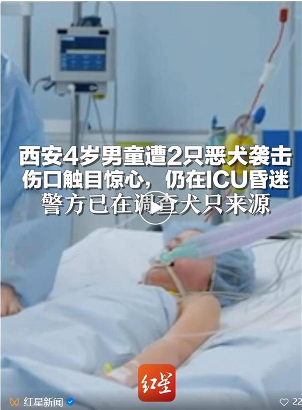 4歲男童遭惡犬襲擊住進(jìn)ICU，狗咬人為何就管不??？