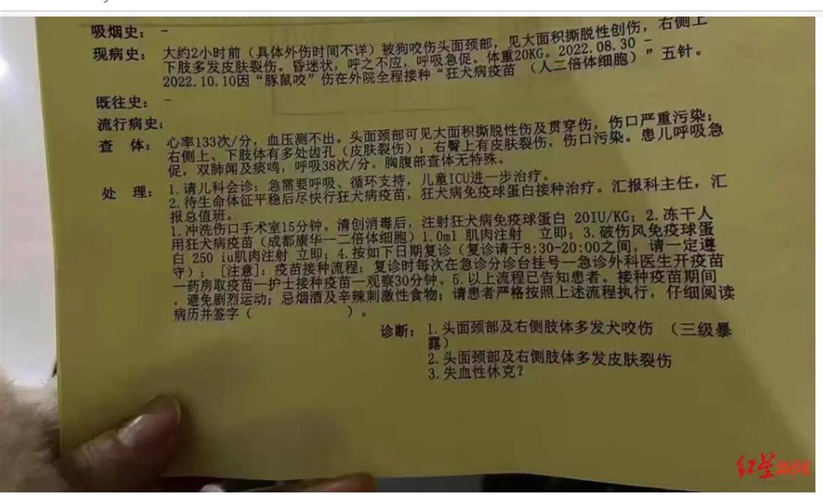 4歲男童遭惡犬襲擊住進(jìn)ICU，狗咬人為何就管不??？