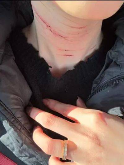 前男友公開金賽綸自殘照，稱她的死與金秀賢無關(guān)
