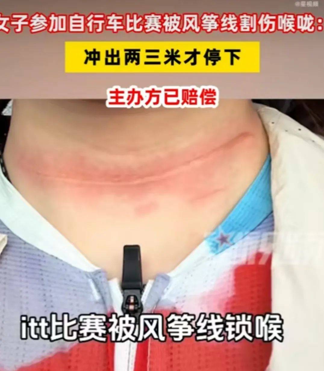騎友在成都環(huán)城綠道險(xiǎn)遭“割頭”！春季騎行，警惕空中“致命風(fēng)箏線”