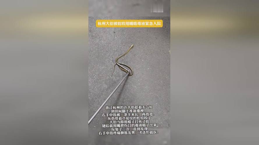 杭州大伯野外被蛇咬，用嘴吸毒液后緊急入院的驚險(xiǎn)事件