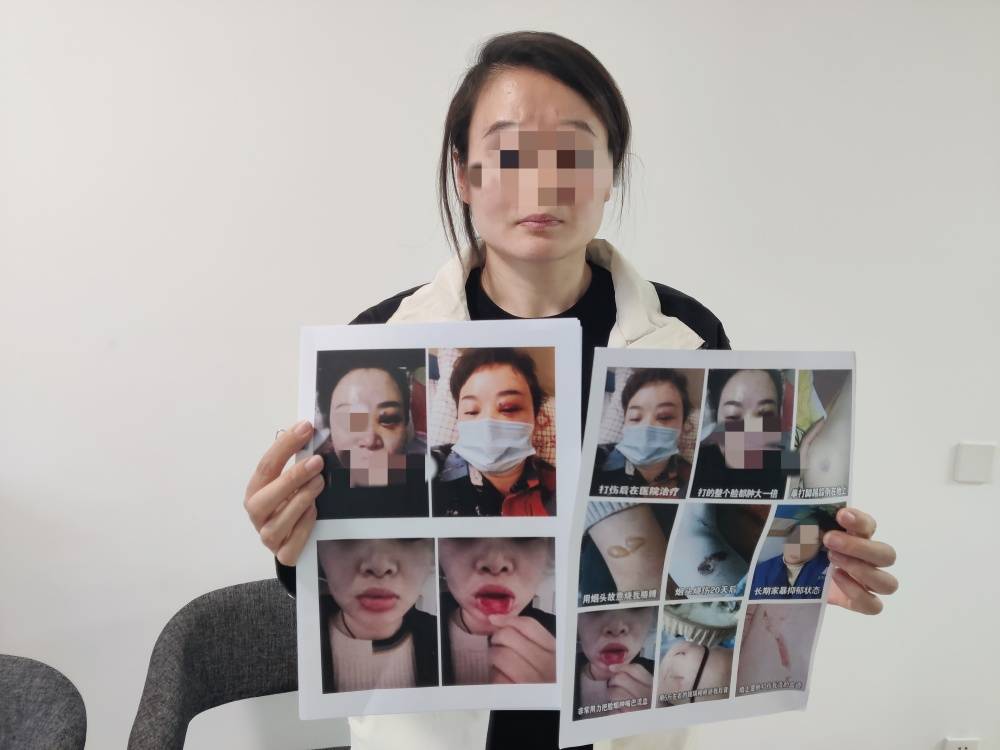鄭州一女子被企業(yè)家丈夫家暴最新進(jìn)展：已要回孩子撫養(yǎng)權(quán)