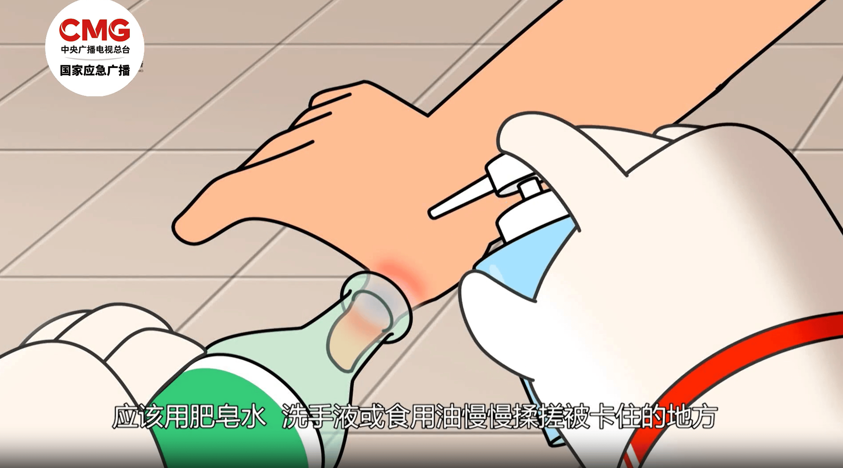 男子昏迷數(shù)日無人知竟是被卡在家中 居家意外傷害這樣防范