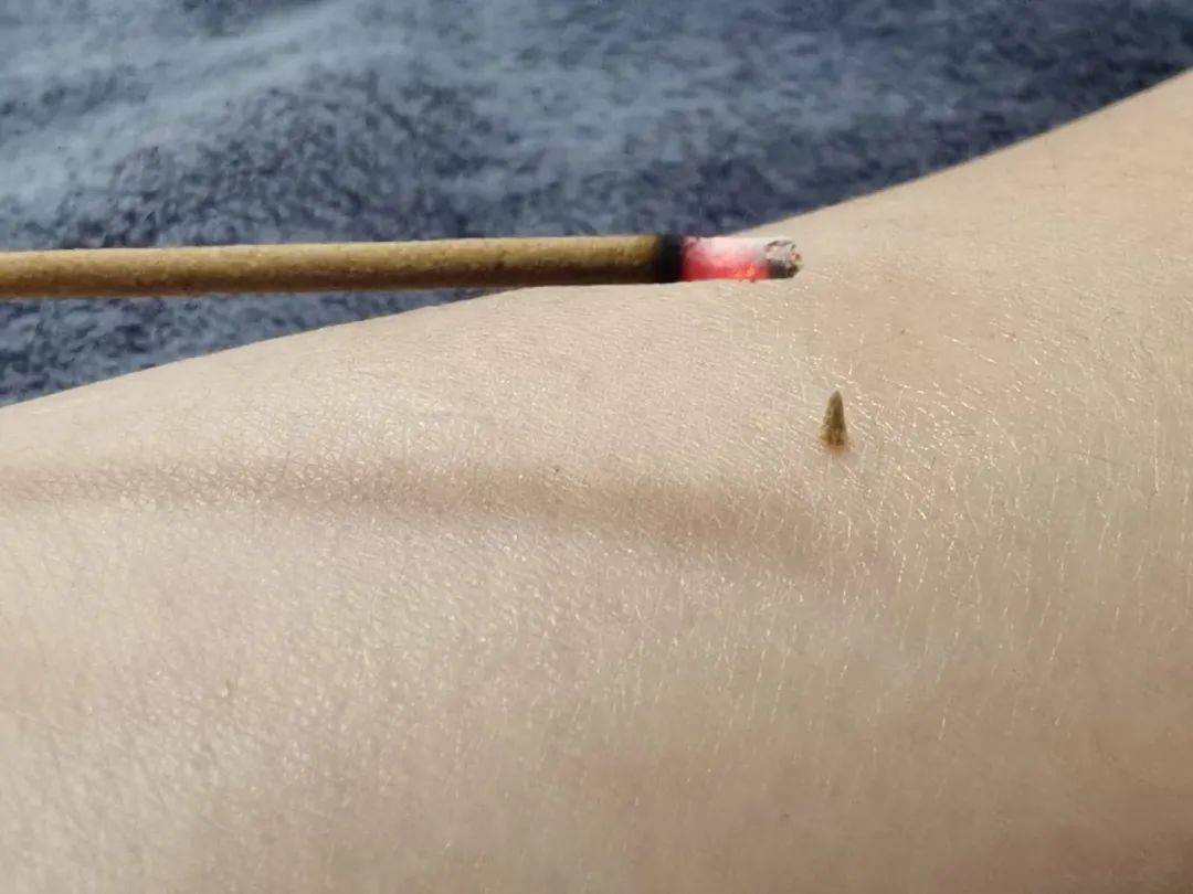 醒來“天塌了”！深圳一女子眼睛閉不上、嘴巴漏水！這些錯誤很多人會犯