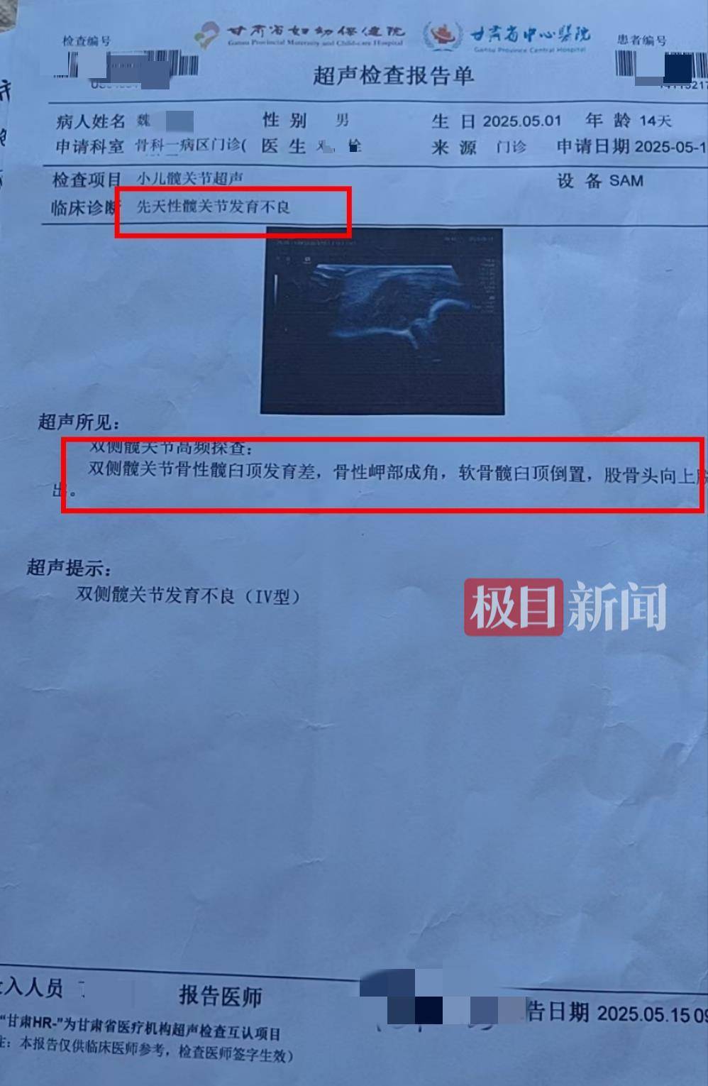 二胎出生查出先天性病癥或落下殘疾，殘疾父母稱醫(yī)院產(chǎn)檢漏檢、未盡告知義務(wù)，醫(yī)院及醫(yī)調(diào)委回應(yīng)