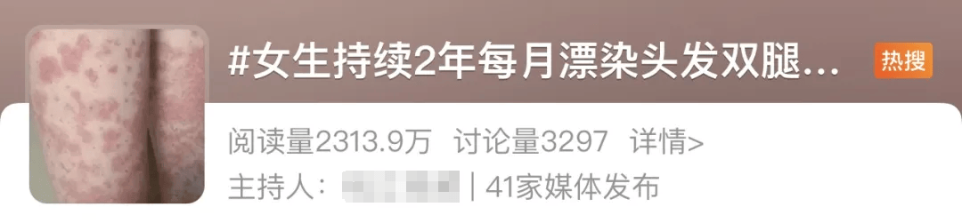 女生每月漂染頭發(fā)，全身長滿紫斑！這些美發(fā)方式可能會致癌！