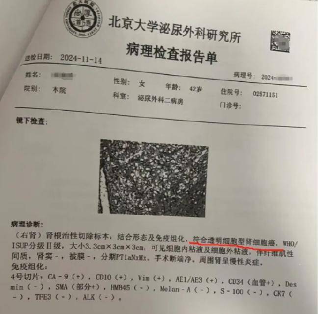 女律師十年體檢未查出癌癥，愛康國賓發(fā)布情況說明