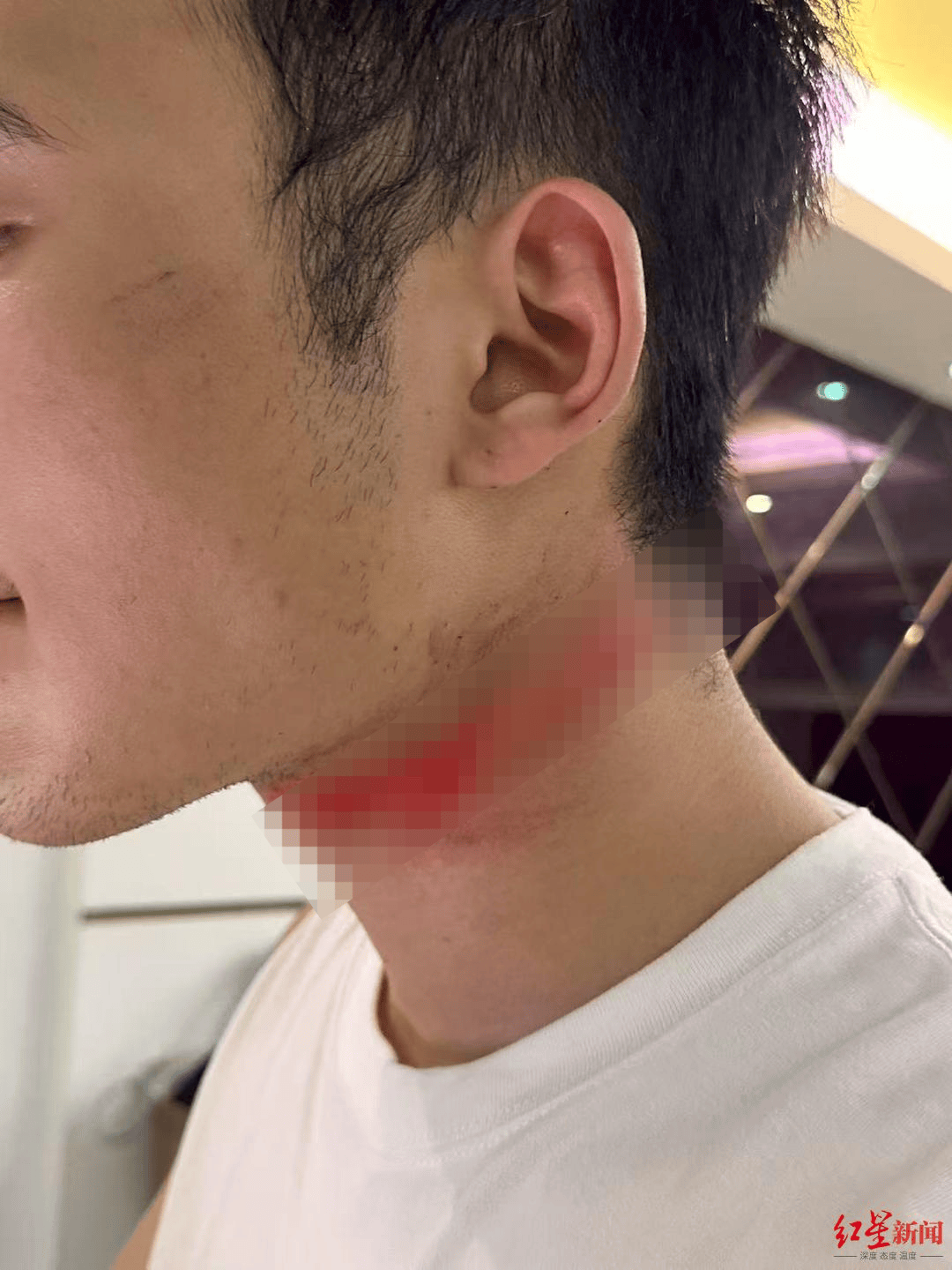 男主播騎車載女友回家被路邊掉落網(wǎng)線勒傷脖子，索賠3萬陷僵局 律師解讀該誰賠